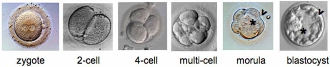 The five days of embryo development before IVF transfer.